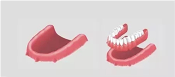 如何做好全口义齿？