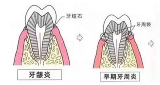 品瑞迈格磁致伸缩治疗仪