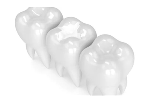 牙本质小管封闭方法,除了激光还有...... 牙本质小管封闭方法,除了激光还有......