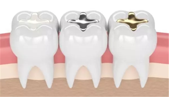 牙本质小管封闭方法,除了激光还有...... 牙本质小管封闭方法,除了激光还有......