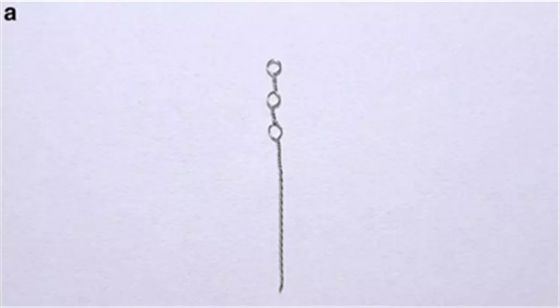 正畸文献赏析--埋伏/阻生尖牙的正畸治疗