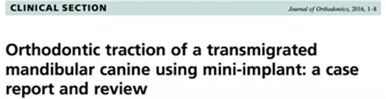 正畸文献赏析--埋伏/阻生尖牙的正畸治疗