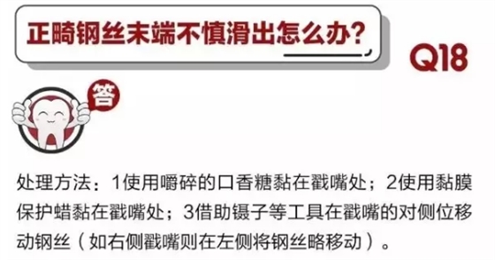 	 牙医停诊了？别怕，请您收下这份居家牙科急症指南！