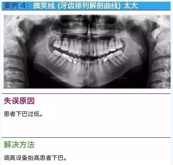 曲断的10大经典失误案例及原因分析！