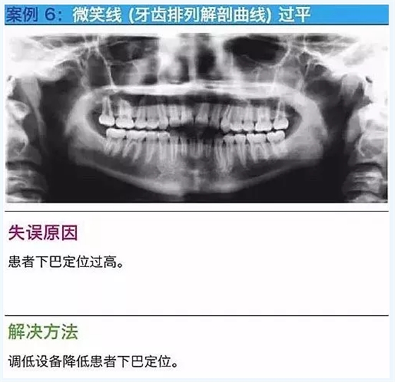 曲断的10大经典失误案例及原因分析！