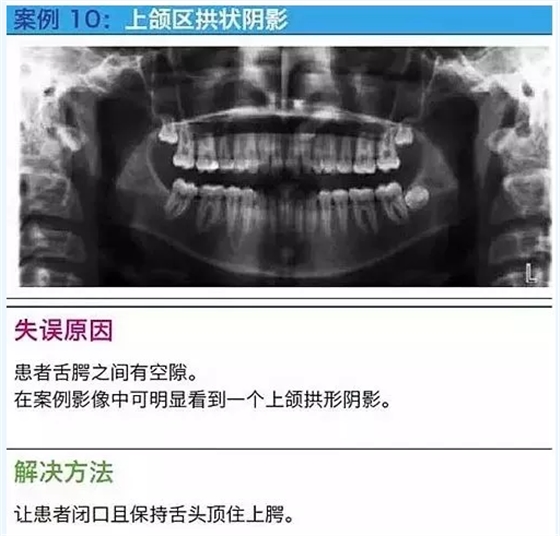 曲断的10大经典失误案例及原因分析！