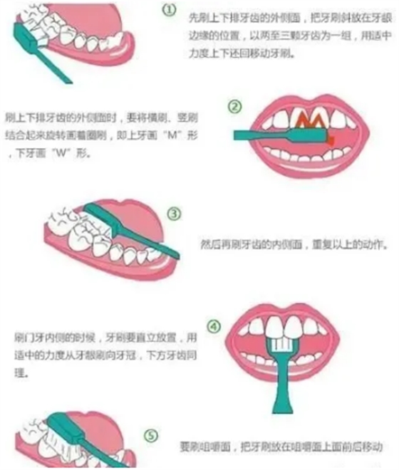 最详细的种植牙流程