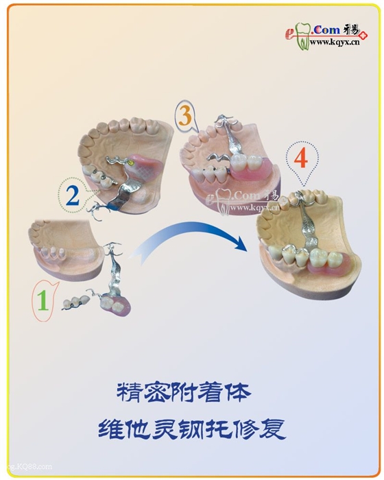 医患沟通图谱收集    推荐