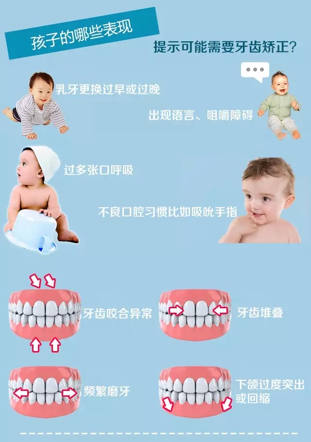 儿童牙齿矫正的时机&方式【看了就懂】