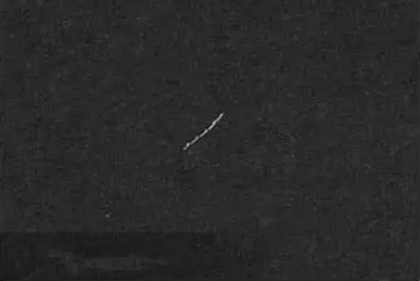 根管治疗中断针及处理方法