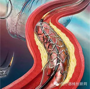 QQ图片20150711134309.png