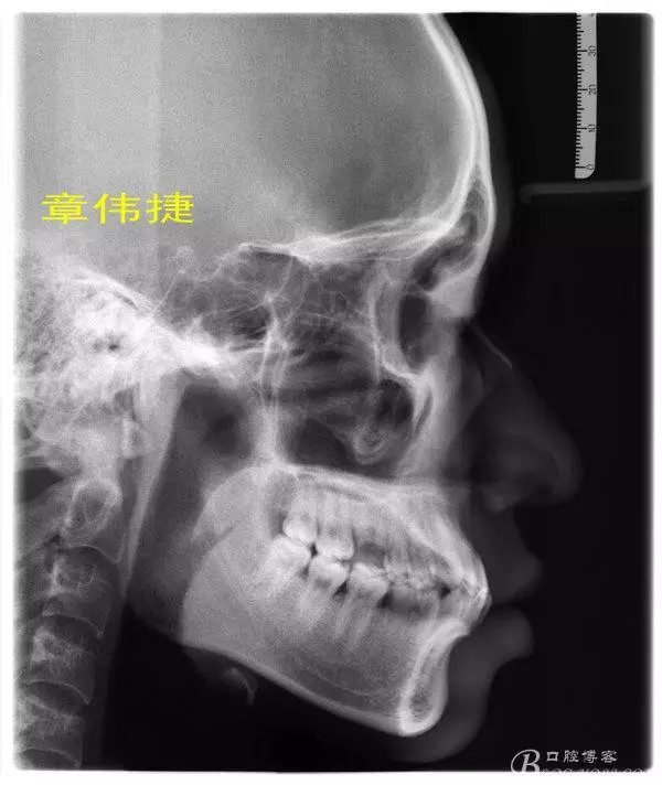 QQ图片20150711161813.png