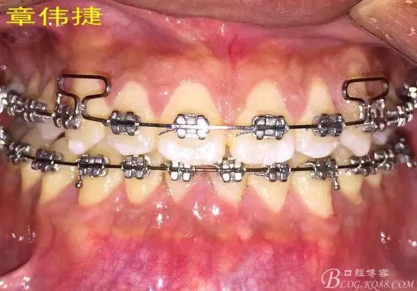 QQ图片20150711162216.png
