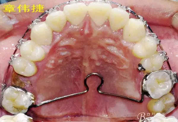 QQ图片20150711162310.png