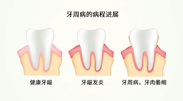 QQ图片20150712113435.png