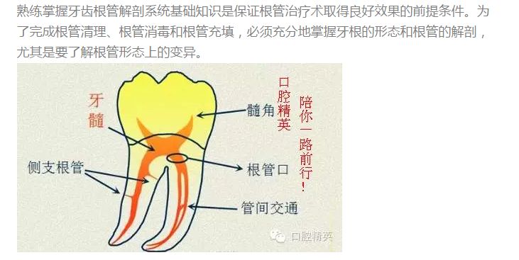解剖提升根管治疗质量  1,概念:髓腔分为两部分:髓室通常是指位于牙冠
