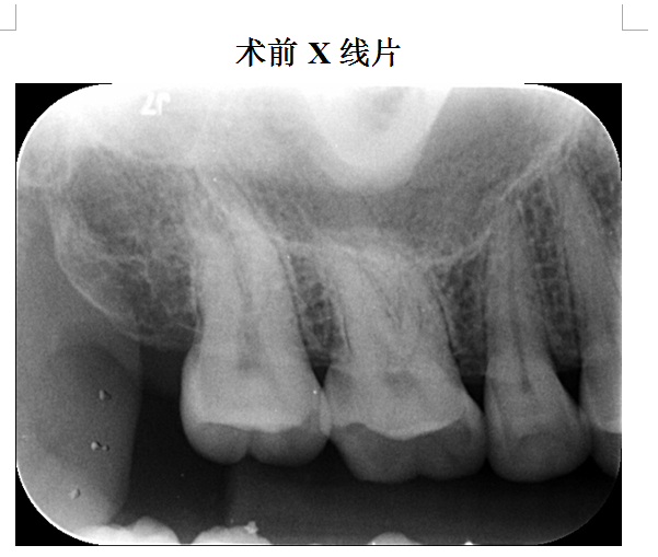 QQ图片20150714085336.png