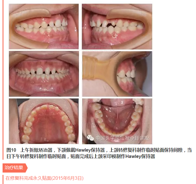 QQ图片20150714135639.png