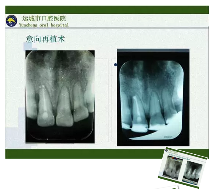 QQ图片20150718100550.png