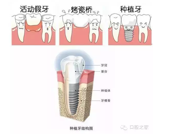 QQ图片20150721094144.png