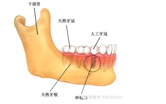 QQ图片20150721100208.png