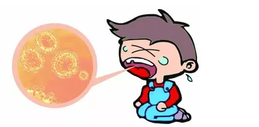 小儿疱疹性咽峡炎的治疗和预防