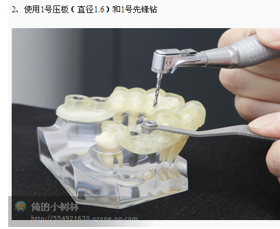 牙科种植利用导板在临床应用