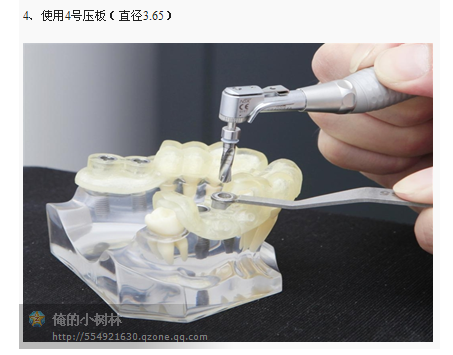 牙科种植利用导板在临床应用
