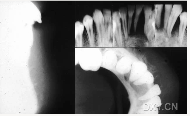 【顶级干货】口腔医生必收藏，口腔影像图片大全！