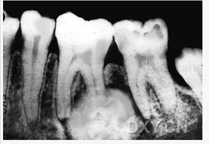 【顶级干货】口腔医生必收藏，口腔影像图片大全！
