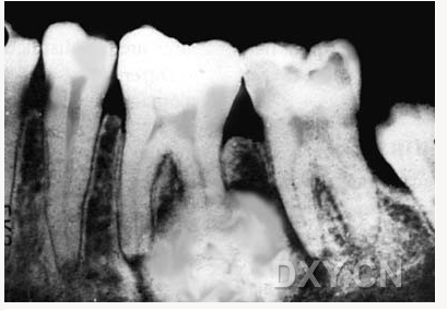 【顶级干货】口腔医生必收藏，口腔影像图片大全！