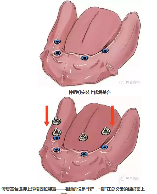 QQ图片20150804092214.png