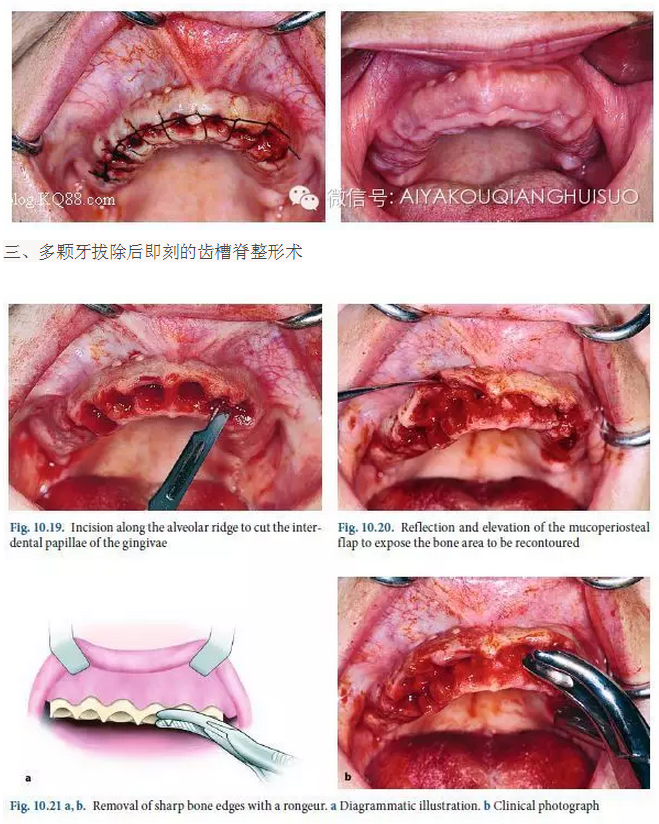 QQ图片20150807105113.png