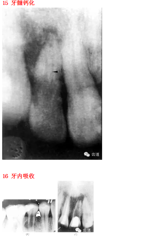 QQ图片20150812095543.png