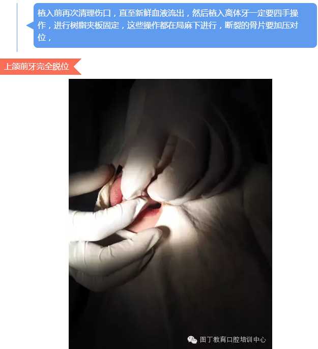 QQ图片20150813150651.png