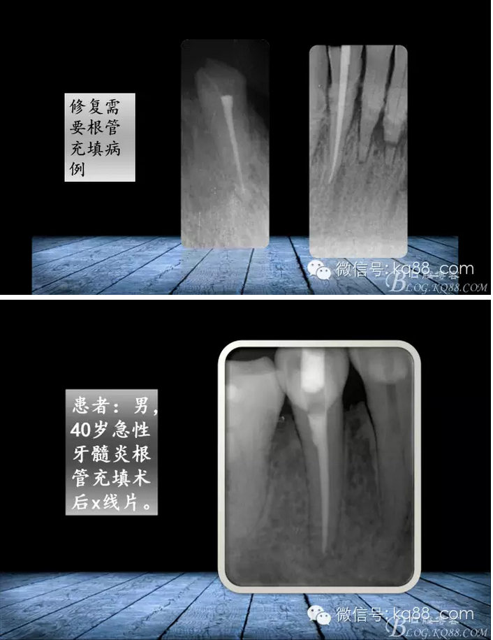 QQ图片20150817140856.png