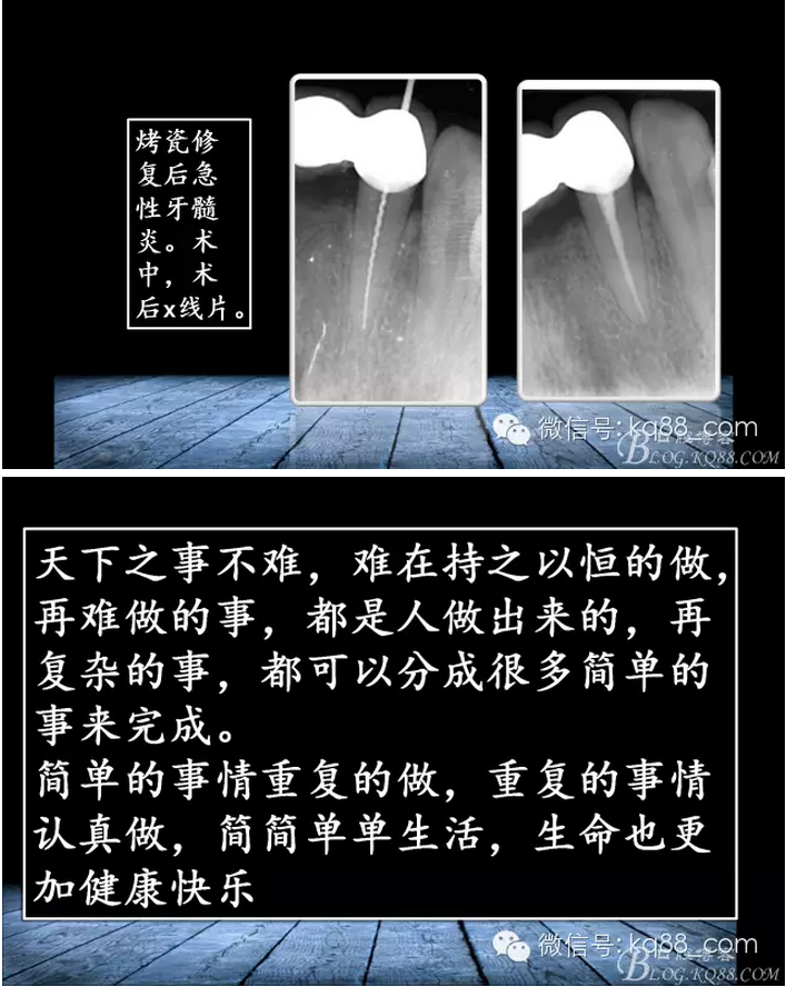 QQ图片20150817141515.png
