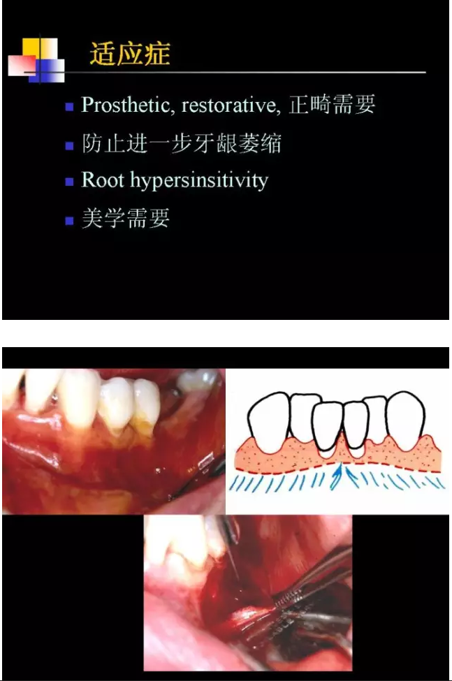 QQ图片20150819095100.png