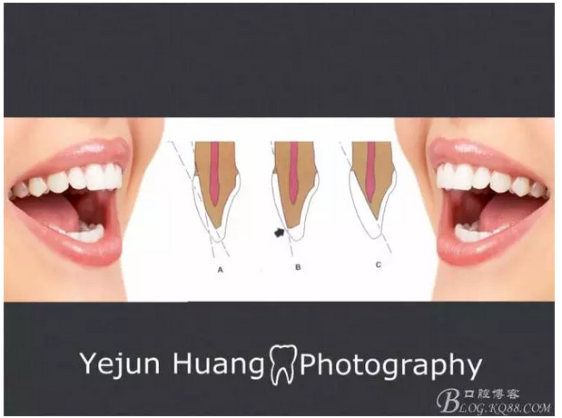 QQ图片20150824173039.png