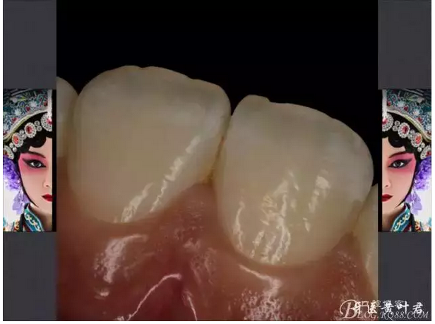 QQ图片20150824175747.png