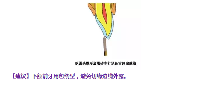 57.png 57.png