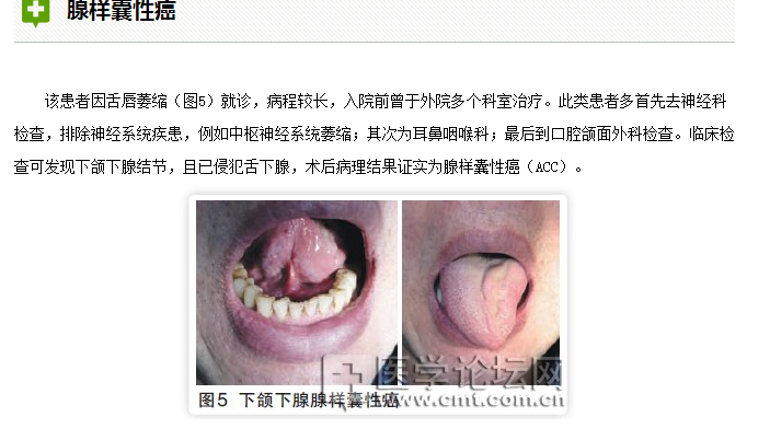 口腔疾病与全身系统性疾病的关系