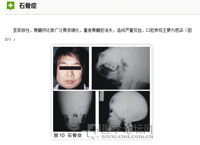 口腔疾病与全身系统性疾病的关系