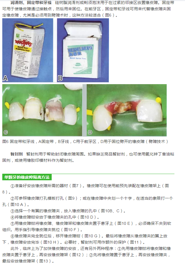 橡皮障隔离之单颗牙隔离方法——陈智教授