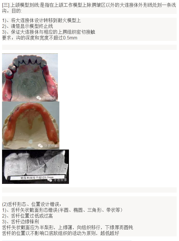活动义齿支架设计的常见错误及预防