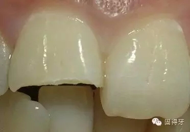 只知道虫牙？快来看看那些你见都没见过的牙病！ 