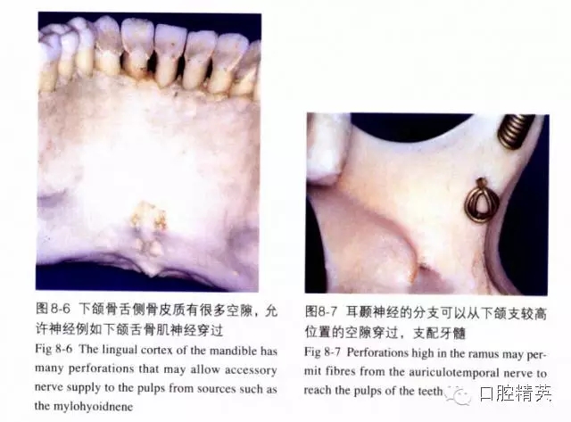 分析局部麻醉失败的常见原因