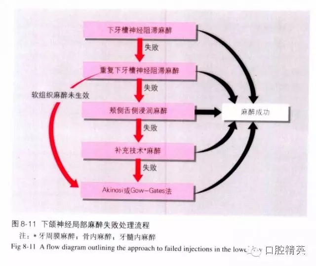 分析局部麻醉失败的常见原因