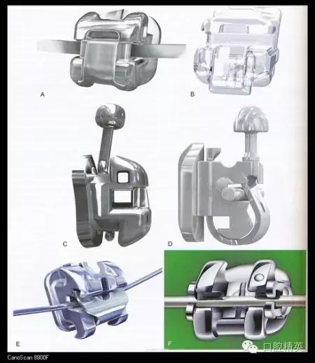 解决牙齿不齐的十八般武器