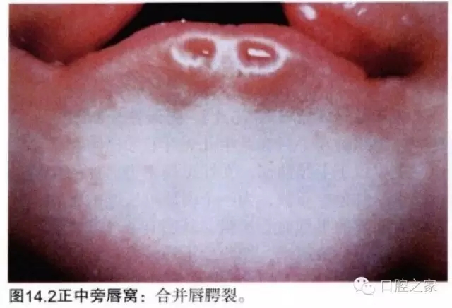 640.webp (1).jpg